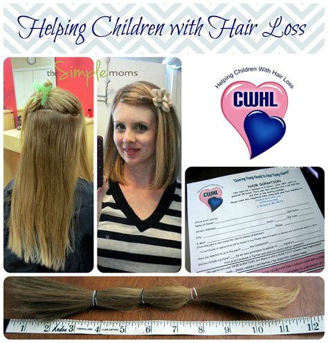 A Simple Cause Children With Hair Loss Thesimplemoms Help Hair