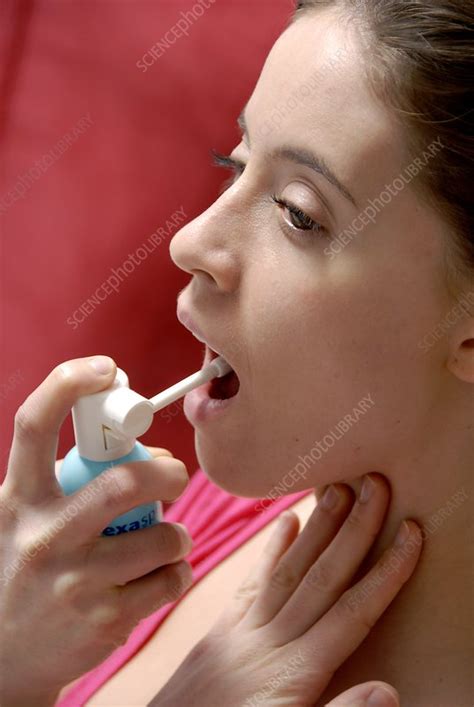Sore Throat Stock Image C004 4152 Science Photo Library