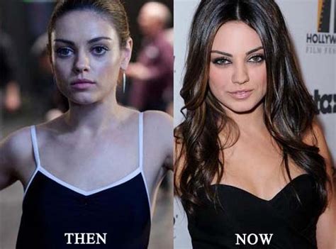 Mila Kunis Breast Implant Photo Before And After Celeb Surgerycom