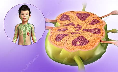 Lymph Node Of A Child Illustration Stock Image F0133079 Science
