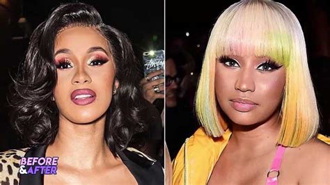 Nicki Minaj Plastic Surgery Before And After Icezen