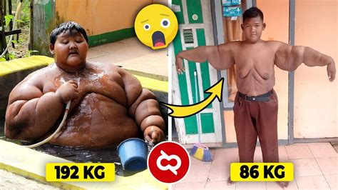 Turun 100 Kg Lebih Begini Transformasi Mengejutkan Orang Gemuk Yang