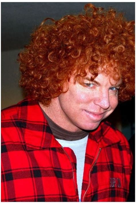 Williams syndrome association, troy, mi. 16 Interesting Facts About Williams Syndrome & Symptoms ...