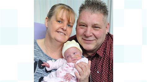 Miracle Baby Defies The Odds After Being Born Weighing Less Than Half A
