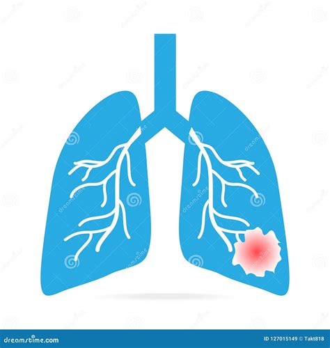 Lung Cancer Blue Icon Medical Concept Illustration Stock Vector