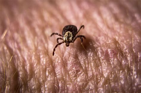 Ticks are bad this year. What kinds of illness can they ...