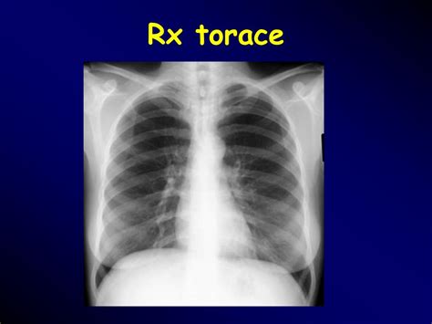 L'incidenza della patologia, in italia, è di circa 55 casi ogni 100.000 abitanti per le donne e 40 casi ogni 100.000 per gli uomini con un tasso di mortalità del. PPT - Pronto soccorso: la diagnostica differenziale delle ...