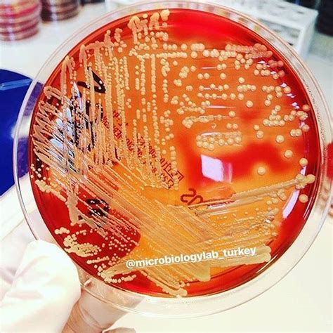 Staphylococcus Aureus Bacteria In Blood Agar Plate Stock Photo Image