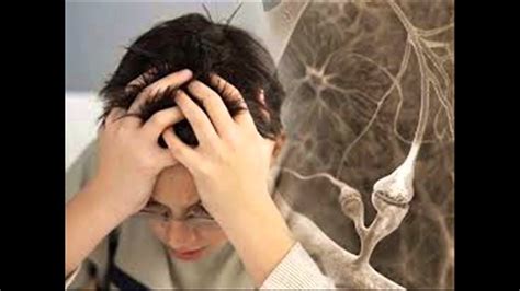 We did not find results for: Fisiopatología - Esclerosis Múltiple - YouTube