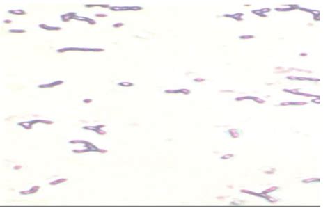 Gram Staining Of Lactic Acid Bacteria Download Scientific Diagram