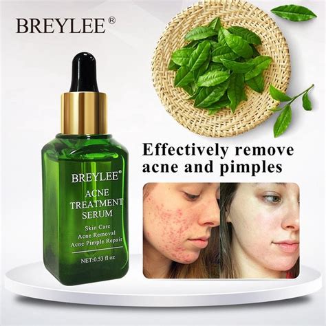 Breylee Acne Treatment Serum Anti Acne Scar Removal Cream Remove Acne