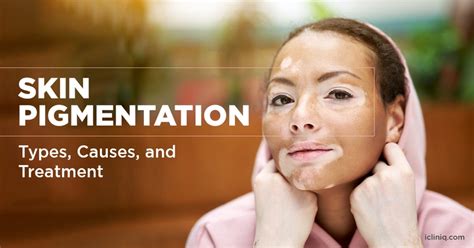 What Are The Different Types Of Skin Pigmentation Disorders