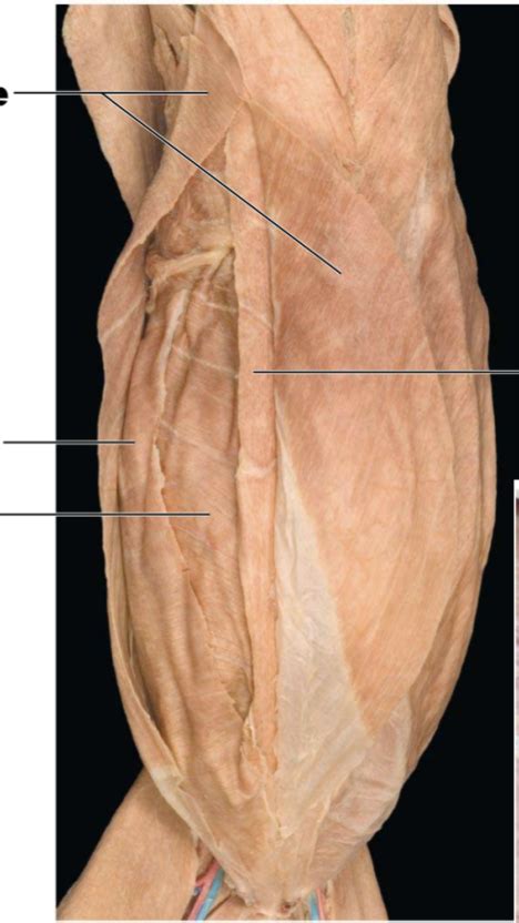 Muscles Of The Abdominal Wall Of The Cat Diagram Quizlet