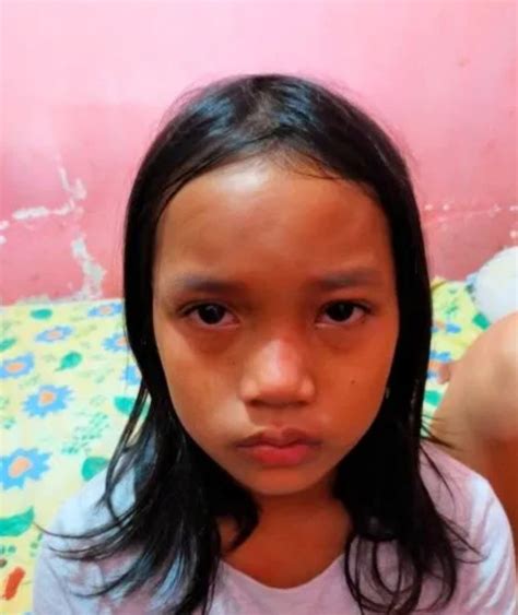Bocah Perempuan Di Makassar Jadi Korban Penganiayaan Bapak Kandungnya