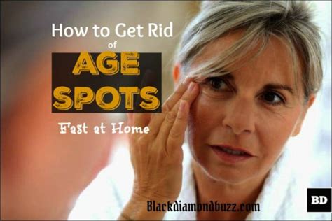 How To Get Rid Of Age Spots On Face 7 Home Remedies That Work Fast