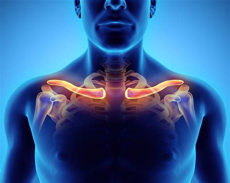 Physical Therapists Guide To Clavicle Fracture