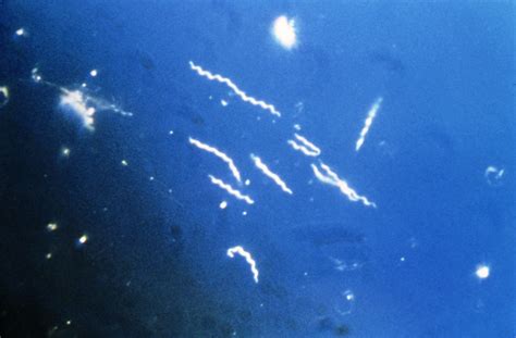 Borrelia is a genus of bacteria of the spirochete phylum. Spirochaetes