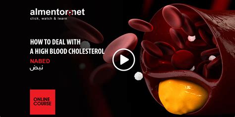 How to Deal with High Blood Cholesterol course | almentor.net
