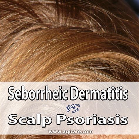 Seborrheic Dermatitis Vs Scalp Psoriasis What Is The Difference Between