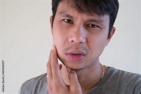 Teetch Problem Asian Male With Painful Cheek Swelling Or Dental