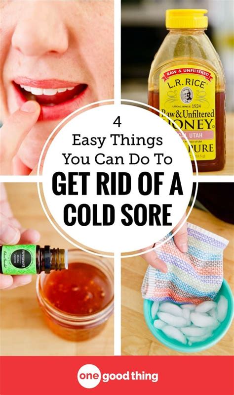 Confused About Cold Sores Learn What They Are What Causes Them And