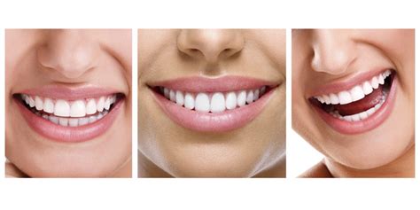 Diseño De Sonrisas Clínica Dental Gramadent