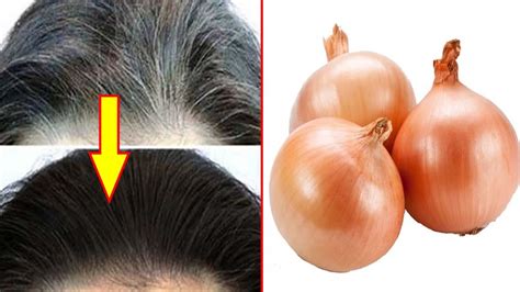 Are there any home remedies for white hair in young age? Home Remedies Turn White Hair To Black Hair Naturally At ...