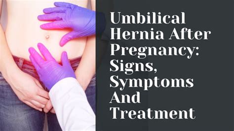 Umbilical Hernia After Pregnancy Signs Symptoms And Treatment