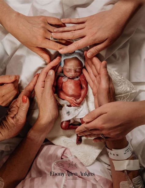 Powerful Winners of Birth Photography Contest Celebrate the Emotions of