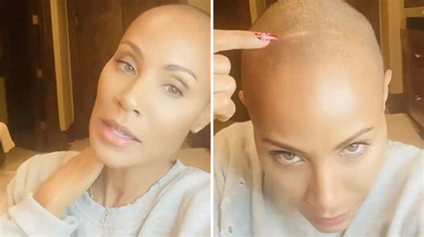Jada Pinkett Smith Opens Up About Hair Loss Caused By Alopecia It