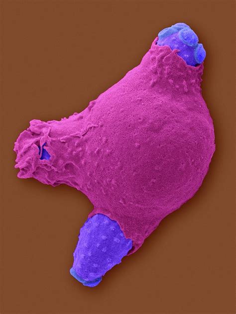 Neutrophil Phagocytosis Of Candida Photograph By Dennis Kunkel