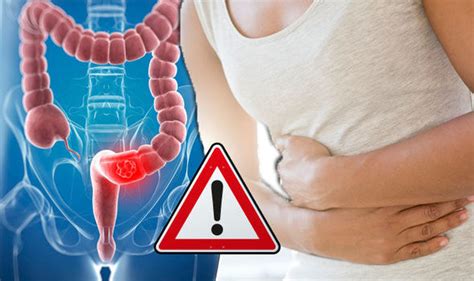 Bowel Cancer Warning The One Sign Of The Condition That You Should