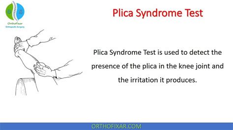 Plica Syndrome Test Syndrome Test Human Knee