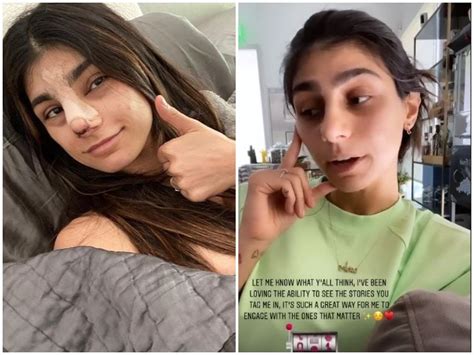 Adult Film Star Mia Khalifa Nose Surgury Photos Goes Viral See Hot And Bold Photos Of Star In
