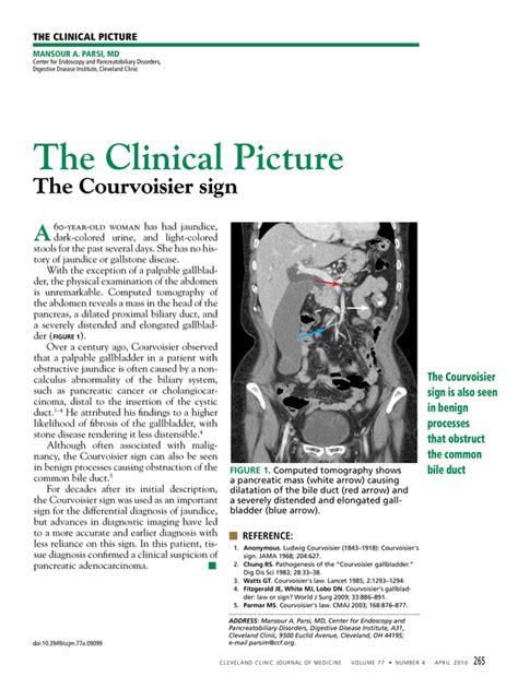 The Courvoisier Sign Cleveland Clinic Journal Of Medicine