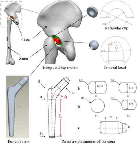 A Threedimensional Model Of An Integrated Hip System And Design