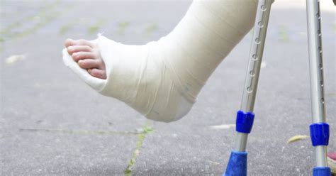 Exercises For An Ankle In A Cast Livestrongcom