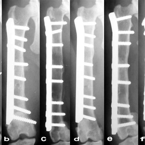 A F Craniocaudal Radiograph Of Cortical Bone Autografts In The Six
