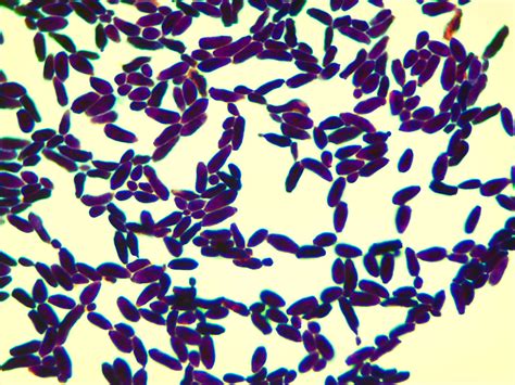 Micrograph Candida Albicans Gram Stain 1000x P000024 OER Commons