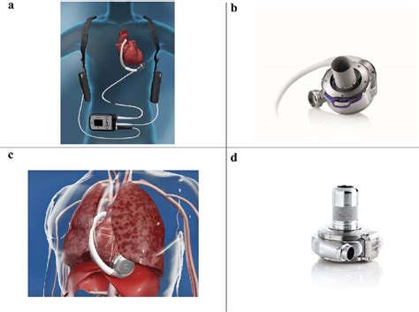 Schematic Presentation Of The Heartmate 3 A And Heartware Lvad C