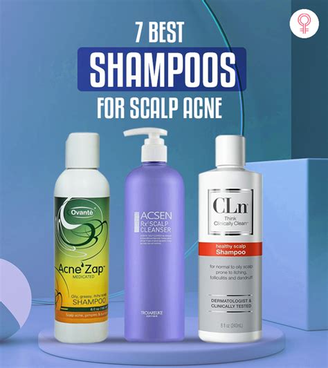 Medicated Shampoo For Scalp Acne A Comprehensive Guide Martlabpro
