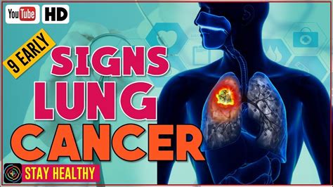 Lung cancer is a cancer that begin in the lungs, one of our body's most fragile organs. 9 Early Symptoms of Lung Cancer - Lung Cancer Warning ...