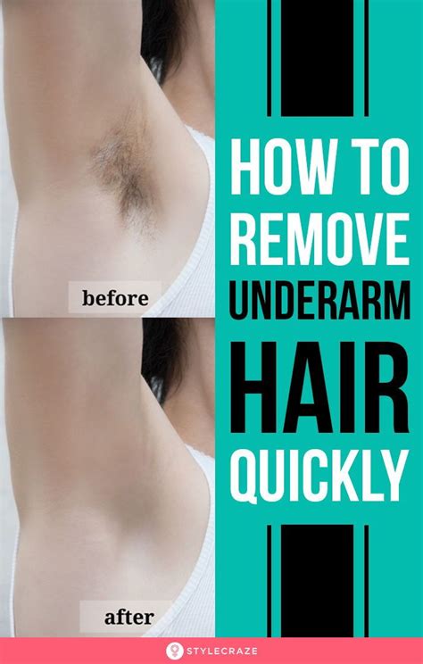 How To Remove Underarm Hair In Just 2 Minutes Simple Natural Solution Underarm Hair