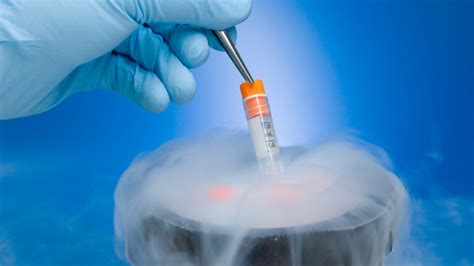 What Are The Benefits Of Getting Cryogenics Hirharang