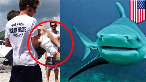 Shark Attack Young Boy Bitten By Bull Shark Off Floridas Cocoa Beach