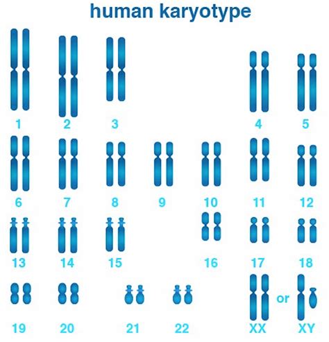 Male Vs Female Karyotype What Is The Difference Between Male And Female Karyotypes Pediaa Com
