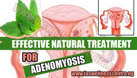 Effective Natural Treatment For Adenomyosis Ias Wellness Centre