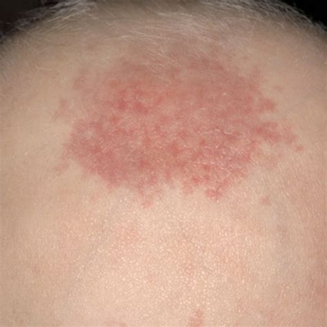 Baby Skin Issues And Conditions What To Expect