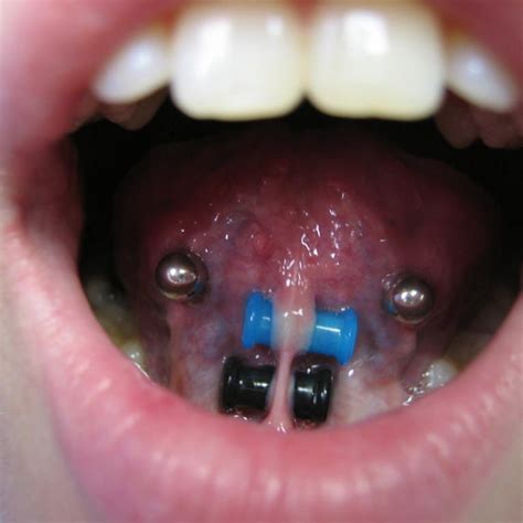 45 Extreme Piercings That Will Scare You