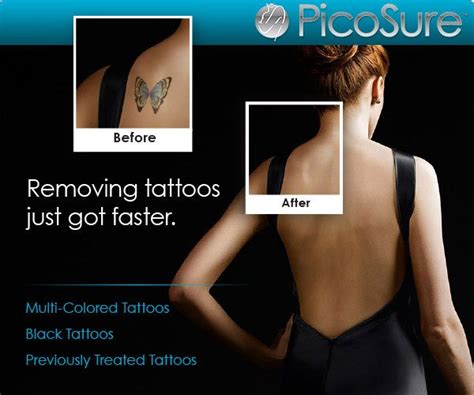 Picosure Laser Tattoo Removal Advanced Cosmetic Cincinnati